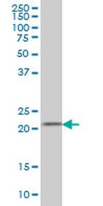 DHFR Antibody in Western Blot (WB)