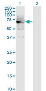 DKC1 Antibody in Western Blot (WB)