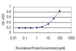 DLD Antibody in ELISA (ELISA)