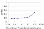 DLD Antibody in ELISA (ELISA)