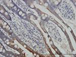 DLD Antibody in Immunohistochemistry (Paraffin) (IHC (P))