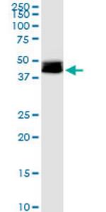 DLST Antibody in Western Blot (WB)