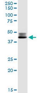 DLST Antibody in Western Blot (WB)