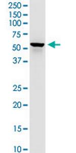 DLST Antibody in Western Blot (WB)