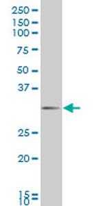 DLX1 Antibody in Western Blot (WB)