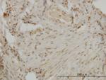 DLX2 Antibody in Immunohistochemistry (Paraffin) (IHC (P))