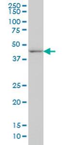 DLX2 Antibody in Western Blot (WB)