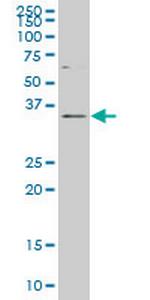 DLX2 Antibody in Western Blot (WB)