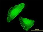 DLX5 Antibody in Immunocytochemistry (ICC/IF)