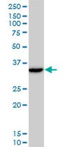 DLX5 Antibody in Western Blot (WB)