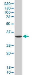 DLX5 Antibody in Western Blot (WB)