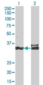 DLX5 Antibody in Western Blot (WB)