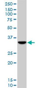 DLX5 Antibody in Western Blot (WB)