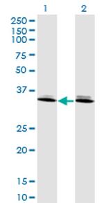 DLX6 Antibody in Western Blot (WB)