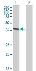 DNASE2 Antibody in Western Blot (WB)