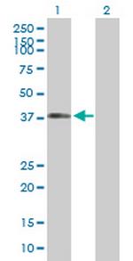 DYNC1H1 Antibody in Western Blot (WB)