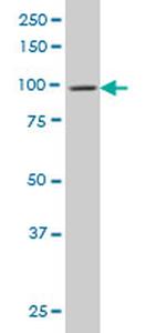 DNM2 Antibody in Western Blot (WB)