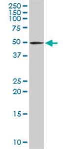 TRDMT1 Antibody in Western Blot (WB)