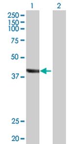 TRDMT1 Antibody in Western Blot (WB)