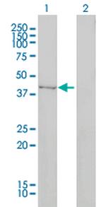 DNMT2 Antibody in Western Blot (WB)