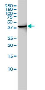 DNMT2 Antibody in Western Blot (WB)