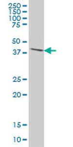 DPH1 Antibody in Western Blot (WB)