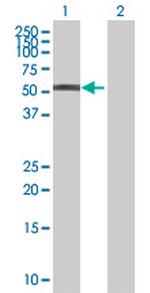 DPH2 Antibody in Western Blot (WB)