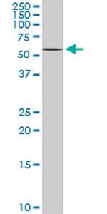 DPH2 Antibody in Western Blot (WB)