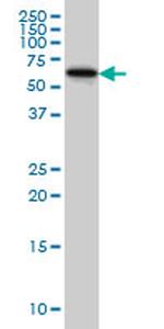 DPH2 Antibody in Western Blot (WB)