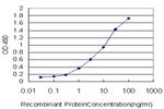 DPYD Antibody in ELISA (ELISA)