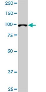 DPYD Antibody in Western Blot (WB)