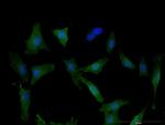 DPYD Antibody in Immunocytochemistry (ICC/IF)