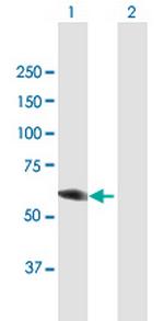 DPYSL3 Antibody in Western Blot (WB)