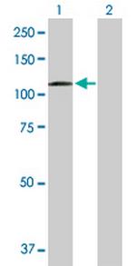 DSC2 Antibody in Western Blot (WB)