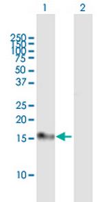 DSCR1 Antibody in Western Blot (WB)