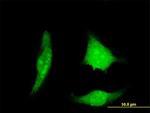 DSCR1 Antibody in Immunocytochemistry (ICC/IF)