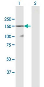 DSG1 Antibody in Western Blot (WB)