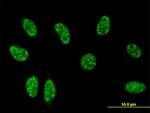 TSC22D3 Antibody in Immunocytochemistry (ICC/IF)