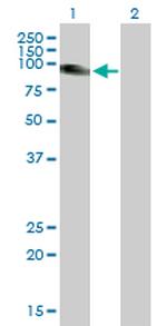 SLC26A2 Antibody in Western Blot (WB)