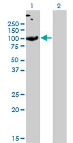 SLC26A2 Antibody in Western Blot (WB)