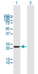 DTYMK Antibody in Western Blot (WB)