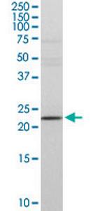 DTYMK Antibody in Western Blot (WB)