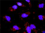 DUSP4 Antibody in Proximity Ligation Assay (PLA) (PLA)