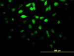 DUSP5 Antibody in Immunocytochemistry (ICC/IF)