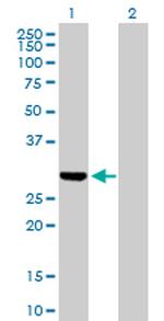 DUT Antibody in Western Blot (WB)