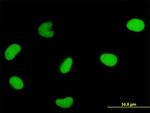 DUT Antibody in Immunocytochemistry (ICC/IF)