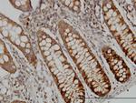 DUT Antibody in Immunohistochemistry (Paraffin) (IHC (P))