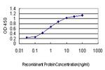 DYRK1A Antibody in ELISA (ELISA)