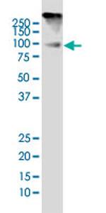 DYRK1A Antibody in Western Blot (WB)