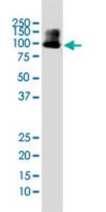 DYRK1A Antibody in Western Blot (WB)